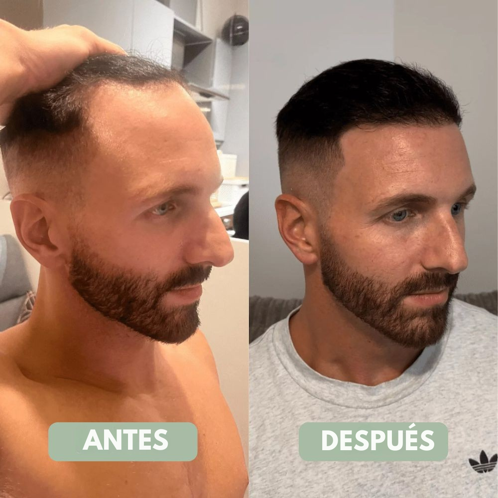 Bodywise™ Sérum para el Crecimiento del Cabello