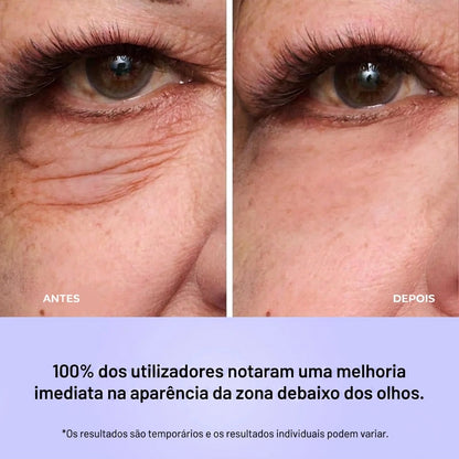 Reafirmante Instantâneo para o Contorno dos Olhos – Compatível com Maquilhagem